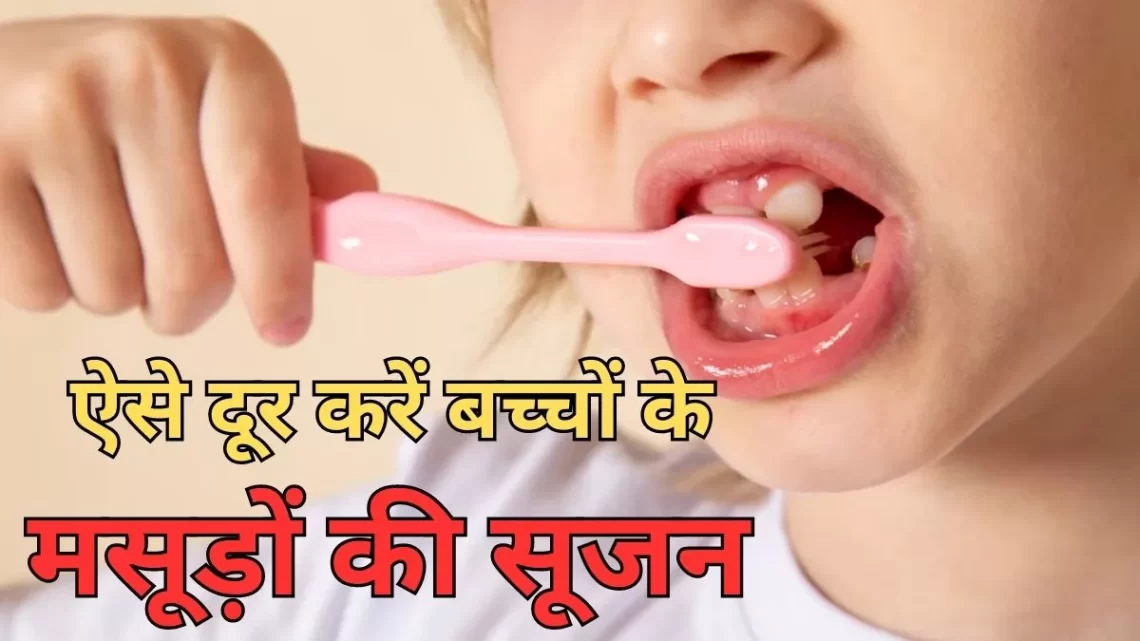 Kids Oral Hygiene: मसूड़ों की सूजन ने कर दिया है आपके बच्चे को परेशान, तो इन आसान उपायों से पाएं जल्द आराम