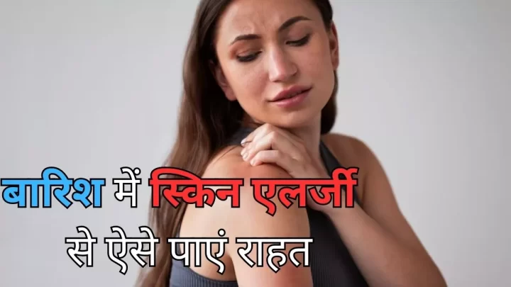 Skin Care Tips: बरसात के मौसम में बढ़ जाती है खुजली और रैशेज की समस्या, तो इन घरेलू उपायों से पाएं राहत