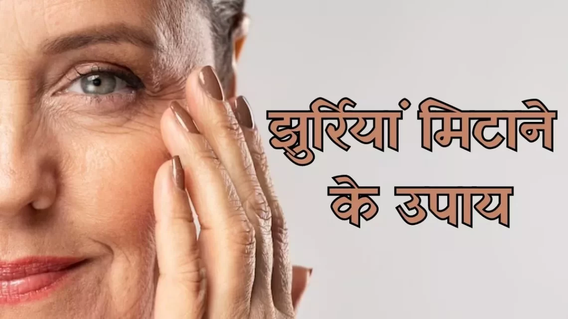 Remedies for Wrinkles: बढ़ती उम्र के साथ ही नजर आने लगी हैं झुर्रियां, तो इन 10 उपायों से पाएं इससे निजात