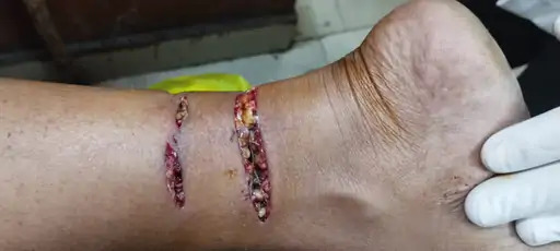 कोरबा में प्रगति नगर कॉलोनी में स्वान ने तीन लोगों को काटा कोरबा में प्रगति नगर कॉलोनी में स्वान ने तीन लोगों को काटा