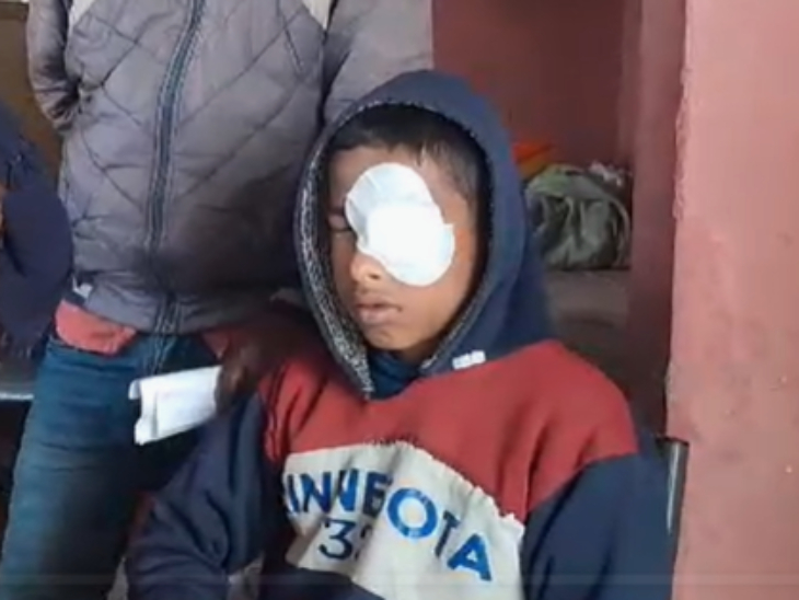 पड़ोसी ने बच्चे की आंख पर फेंका आग, नशे में धूत पाटीदार ने नानी को पीटा, रास्ते के विवाद में मारपीट; 7 पर केस दर्ज पड़ोसी ने बच्चे की आंख पर फेंका आग, नशे में धूत पाटीदार ने नानी को पीटा, रास्ते के विवाद में मारपीट; 7 पर केस दर्ज