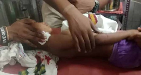 घर के सामने खेल रहे मासूम पर तेंदुए ने किया हमला घर के सामने खेल रहे मासूम पर तेंदुए ने किया हमला
