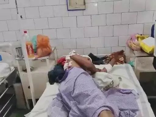 भालू से हुआ सामना, युवक ने किसी तरह संघर्ष कर अपनी जान बचाई, लेकिन…