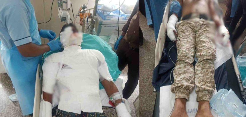 बड़ा हादसा : मॉकड्रिल के दौरान फटा ग्रेनेड, चपेट में आने से 2 पुलिसकर्मी गंभीर, अस्पताल में भर्ती बड़ा हादसा : मॉकड्रिल के दौरान फटा ग्रेनेड, चपेट में आने से 2 पुलिसकर्मी गंभीर, अस्पताल में भर्ती